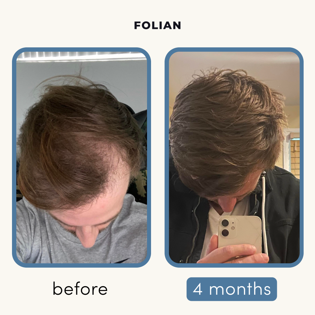 Folian Hair Revival Serum